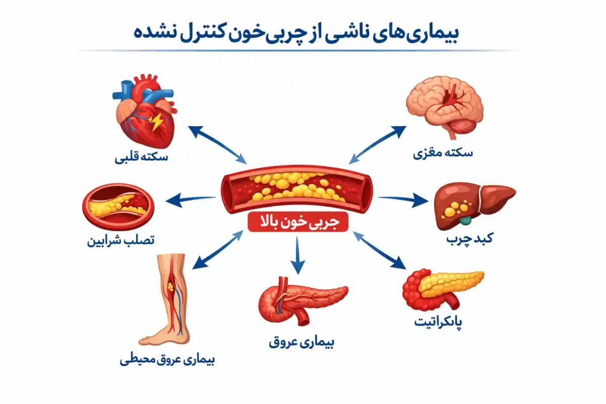 تشخیص و درمان چربی خون چربی خون بالا و بیماریهای مرتبط با آن