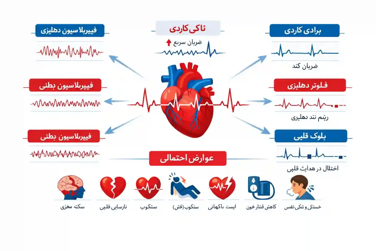 تشخیص و درمان تپش قلب تپش قلب ، آریتمی و اختلالات قلبی مرتبط ، نشانه ها و عوارض