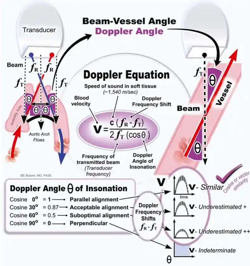 در تصویر اثر زاویه بین موج تابشی و حرکت خون در فرمول داپلر شیفت نمایش داده شده است. هر چه قدر این زاویه به صفر نزدیک تر باشد، قرائت دقیق تر است و اگر به مقدار عمود برسد، یک مقدار نامشخص قرائت میشود برای زوایای میانی با دانستن زاویه و محاسبه کسینوس این زاویه میتوان سرعت را اصلاح نمود
