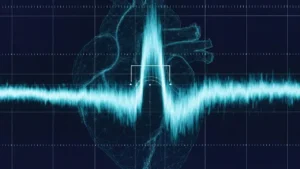 سمبل نمایی از اکوی داپلر طیفی
