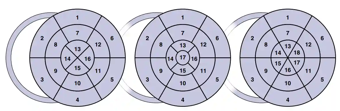در همه مدلها : 1.پایهای قدامی (basal anterior) 2.پایهای قدامی سپتومال (basal anteroseptal) 3.پایهای تحتانی سپتومال (basal inferoseptal) 4.پایهای تحتانی (basal inferior) 5.پایهای تحتانی جانبی (basal inferolateral) 6.پایهای قدامی جانبی (basal anterolateral) 7.میانی قدامی (mid anterior) 8.میانی قدامی سپتومال (mid anteroseptal) 9.میانی تحتانی سپتومال (mid inferoseptal) 10.میانی تحتانی (mid inferior) 11.میانی تحتانی جانبی (mid inferolateral) 12.میانی قدامی جانبی (mid anterolateral) فقط در مدل 16 و 17 سگمنت: 13.اپیکال قدامی (apical anterior) 14.اپیکال سپتومال (apical septal) 15.اپیکال تحتانی (apical inferior) 16.اپیکال جانبی (apical lateral) فقط مدل 17 سگمنتی 17. نوک قلب (apex) فقط مدل ۱۸ سگمنتی 13.اپیکال قدامی (apical anterior) 14.اپیکال قدامی سپتومال (apical anteroseptal) 15.اپیکال تحتانی سپتومال (apical inferoseptal) 16.اپیکال تحتانی (apical inferior) 17.اپیکال تحتانی جانبی (apical inferolateral) 18.اپیکال قدامی جانبی (apical anterolateral) در همه مدلها :1.پایهای قدامی (basal anterior) 2.پایهای قدامی سپتومال (basal anteroseptal) 3.پایهای تحتانی سپتومال (basal inferoseptal) 4.پایهای تحتانی (basal inferior) 5.پایهای تحتانی جانبی (basal inferolateral) 6.پایهای قدامی جانبی (basal anterolateral) 7.میانی قدامی (mid anterior) 8.میانی قدامی سپتومال (mid anteroseptal) 9.میانی تحتانی سپتومال (mid inferoseptal) 10.میانی تحتانی (mid inferior) 11.میانی تحتانی جانبی (mid inferolateral) 12.میانی قدامی جانبی (mid anterolateral) فقط در مدل 16 و 17 سگمنت: 13.اپیکال قدامی (apical anterior) 14.اپیکال سپتومال (apical septal) 15.اپیکال تحتانی (apical inferior) 16.اپیکال جانبی (apical lateral) فقط مدل 17 سگمنتی 17. نوک قلب (apex) فقط مدل ۱۸ سگمنتی 13.اپیکال قدامی (apical anterior) 14.اپیکال قدامی سپتومال (apical anteroseptal) 15.اپیکال تحتانی سپتومال (apical inferoseptal) 16.اپیکال تحتانی (apical inferior) 17.اپیکال تحتانی جانبی (apical inferolateral) 18.اپیکال قدامی جانبی (apical anterolateral)
