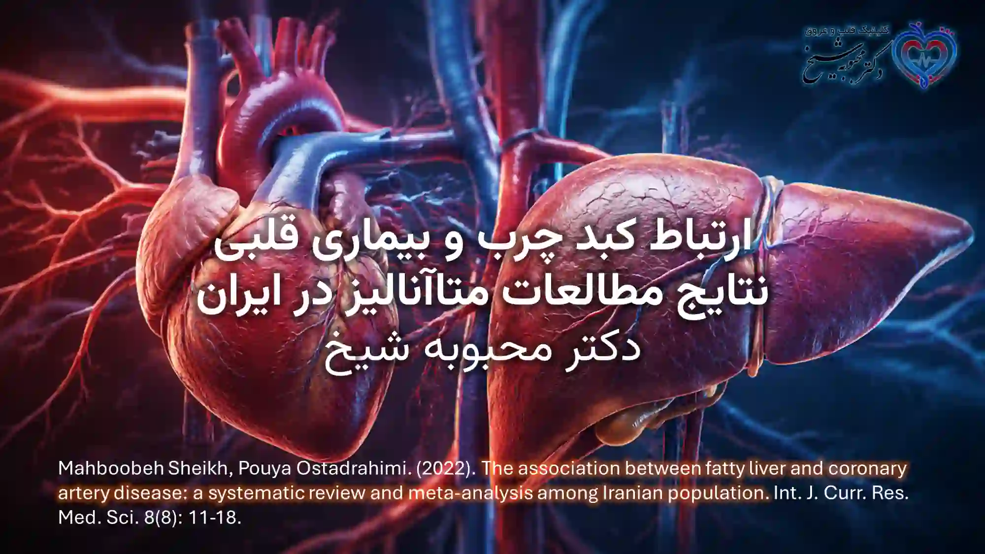 دکتر محبوبه شیخ | مقاله متاآنالیز در مورد ارتباط کبد چرب و بیماری عروق کرونر در ایران